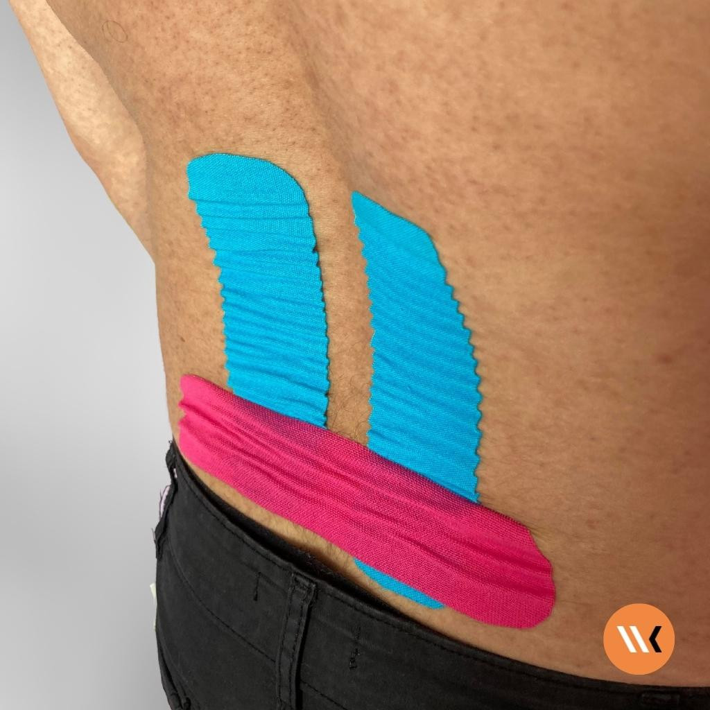 El taping para aliviar el dolor lumbar