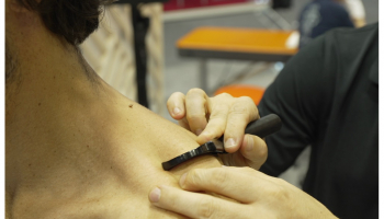 Pourquoi associer les crochets myo-fasciaux EKMAN  et la Tecarthérapie Winback