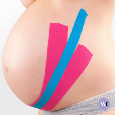 The art of taping to relieve the aches and pains of pregnancy