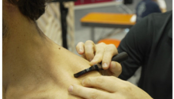 Why combine EKMAN myofascial hooks and Winback Technology?